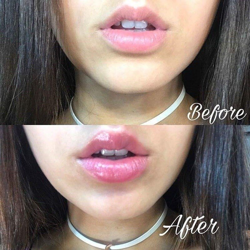 Big Lips Transparent Makeup